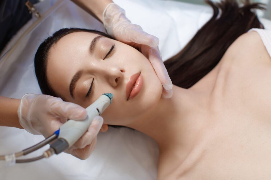 Microneedling Treatment in Great Falls, MT