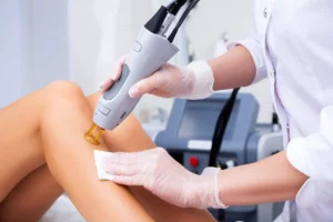 Laser Hair Removal by Allure Aesthetics in Great Falls MT