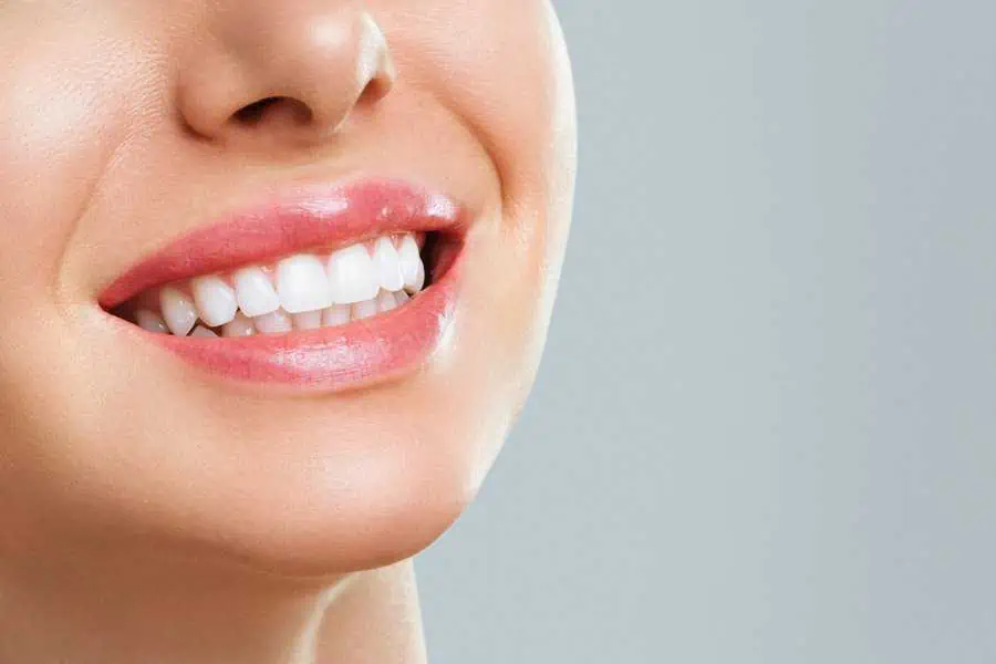 Teeth Whitening by Allure Aesthetics in Montana