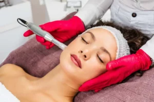Microneedling in Great Falls,MT by Allure Aesthetics LLC