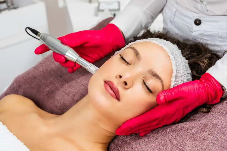 Microneedling in Great Falls,MT by Allure Aesthetics LLC