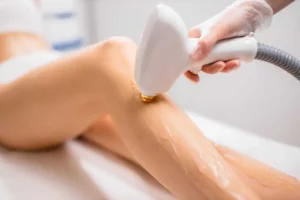 Laser Hair Removal by Allure Aesthetics in Great Falls, MT